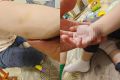 Новосибирец обвинил врачей в том, что они проглядели перелом у его дочки