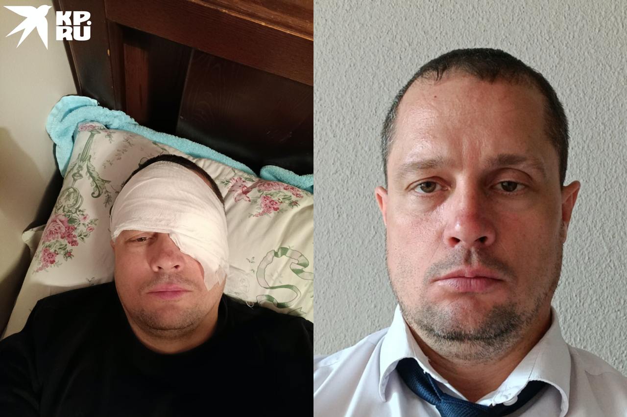 «Я его будил, а он резко вскочил и набросился»: в Новосибирске охранник лишился глаза после драки с пьяным байкером «Я его будил, а он резко вскочил и набросился»: в Новосибирске охранник лишился глаза после драки с пьяным байкером