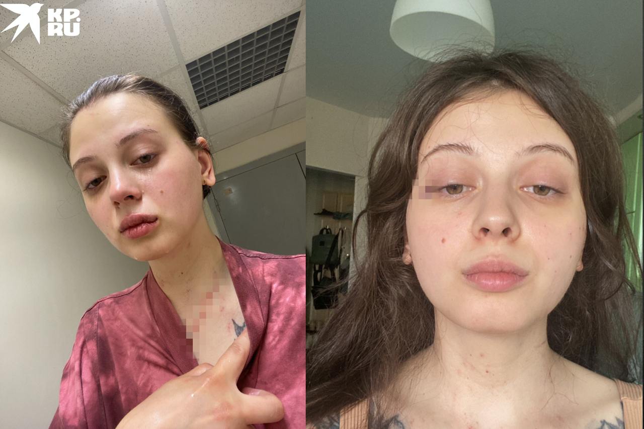 «Преследовал, шантажировал откровенным видео»: в Новосибирске студентка обвинила бывшего парня в избиениях