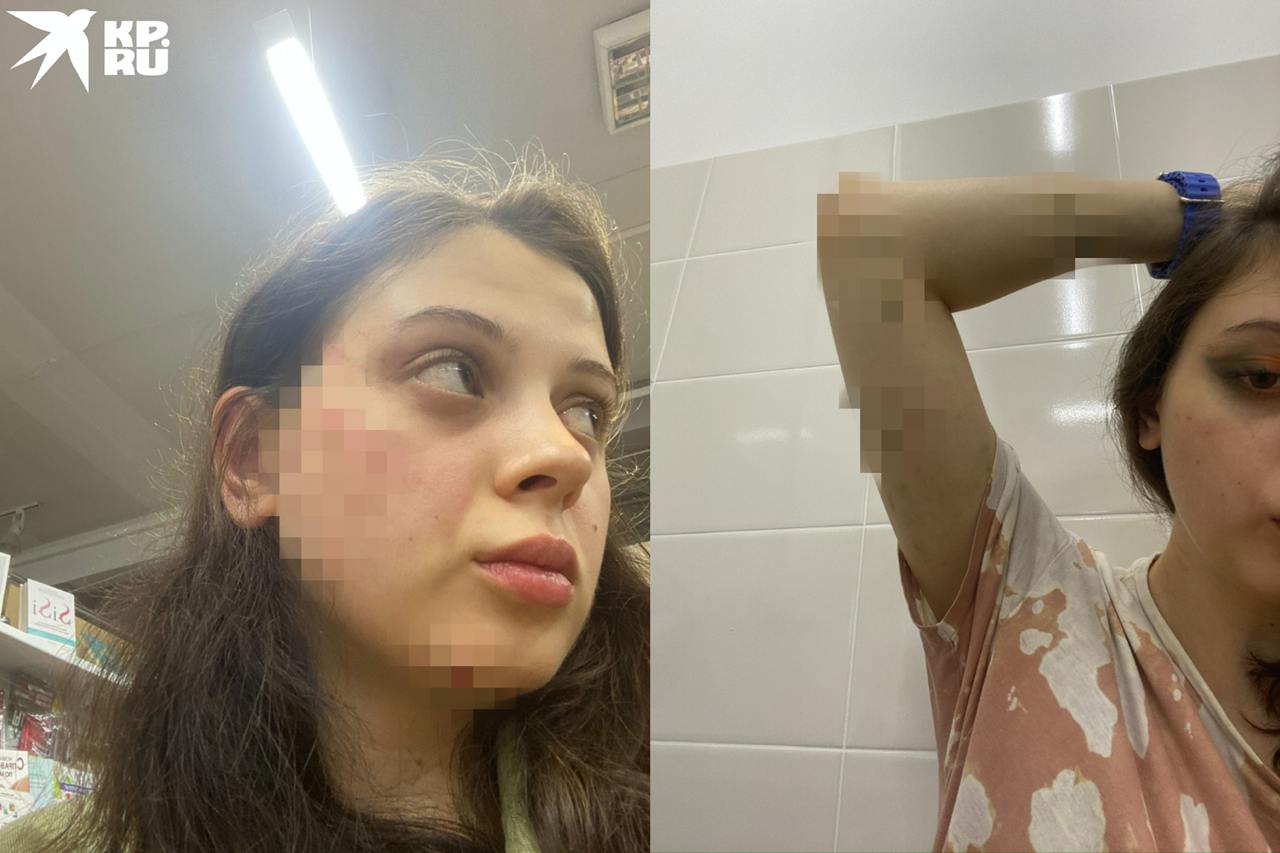 «Преследовал, шантажировал откровенным видео»: в Новосибирске студентка обвинила бывшего парня в избиениях «Преследовал, шантажировал откровенным видео»: в Новосибирске студентка обвинила бывшего парня в избиениях