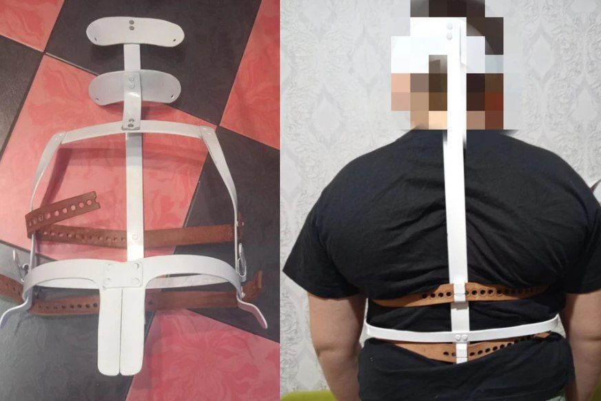 «Он заплакал от боли»: сибирячка судится со школой, где сын учительницы сломал позвоночник её ребенку