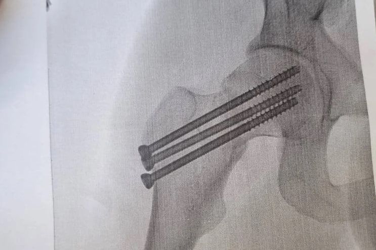 Новосибирский курьер сломал бедро, доставляя заказ — начальство прислало ему промокод на пять тысяч