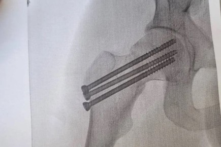 Новосибирский курьер сломал бедро, доставляя заказ — начальство прислало ему промокод на пять тысяч