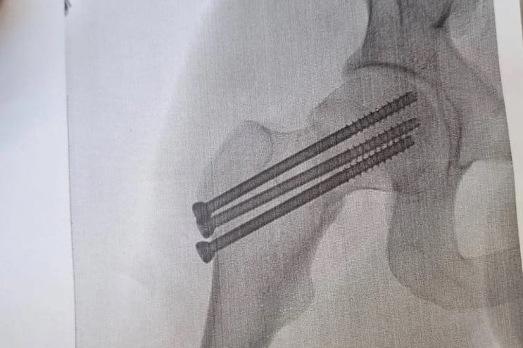 Новосибирский курьер сломал бедро, доставляя заказ — начальство прислало ему промокод на пять тысяч