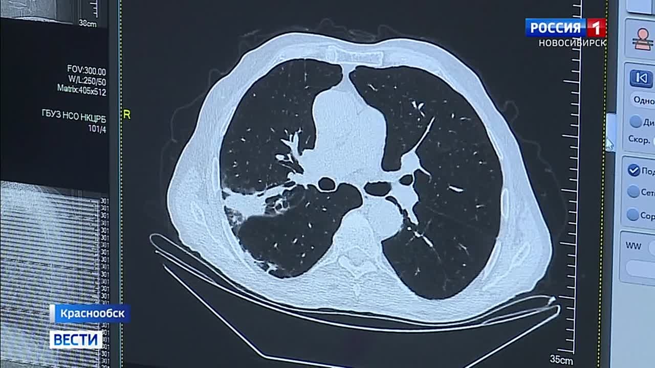 Борьба с раком. В Краснообске уже почти год работает новый центр амбулаторной онкологической помощи