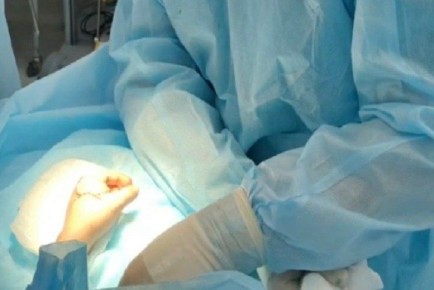 Врачи ампутировали палец шестилетнему жителю Бердска после запуска петарды