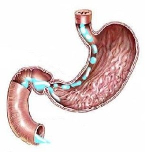 ������� �����: ��� � ����� ������� ������ �� �����������