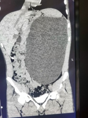 ���������� ����� �������� � ������������ ������� ������� � 17-������� ��������� � ������������