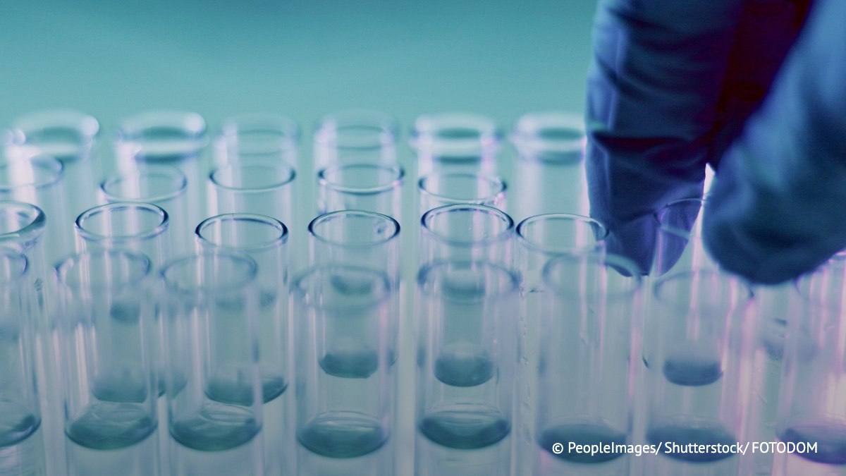 Натуральные пищевые красители на основе натуральных компонентов — черноплодной рябины и сибирской пихты — создали в Новосибирске