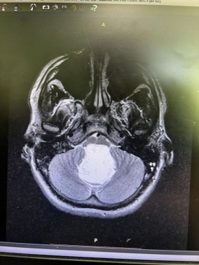 ����������� ������� �������� � ����� �������� � 22-������� ����� ������������� �����