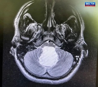 ����������� �������. ������������� ������������ ������� �������������� 22-������� �������� �������� � ��������� ������������� � ������ ��������, ������� �������� ���������� ��-�� ������ �������������� �������