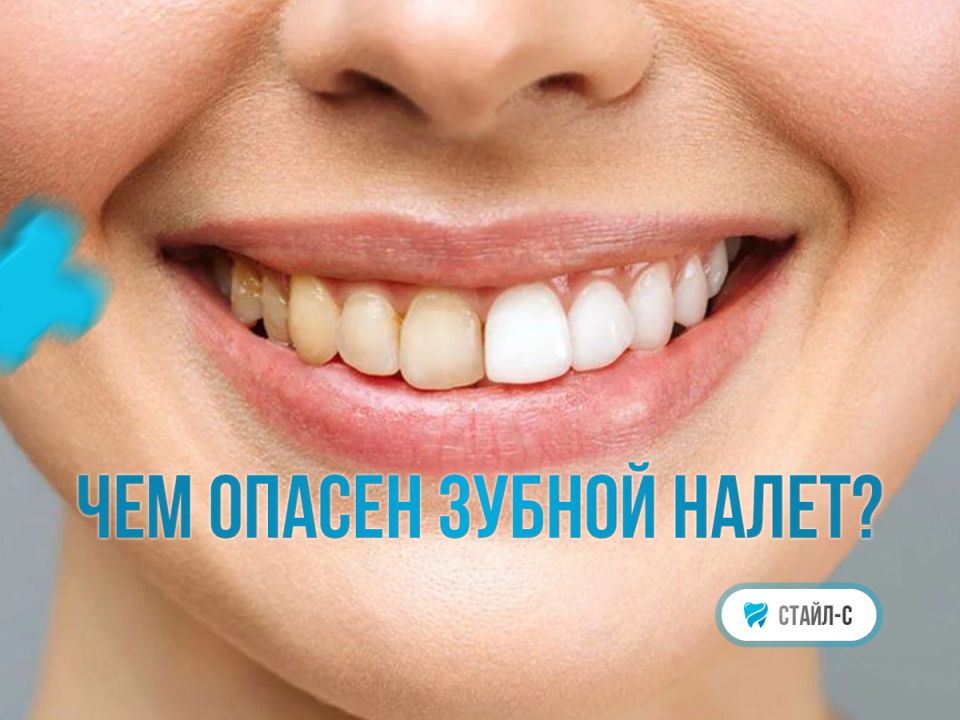 ��������� ������� ������: ������ ��� ����� ����� �������